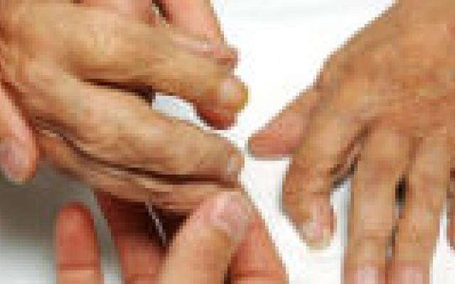 ‘Nog plek voor multidisciplinaire aanpak reumatoïde artritis’