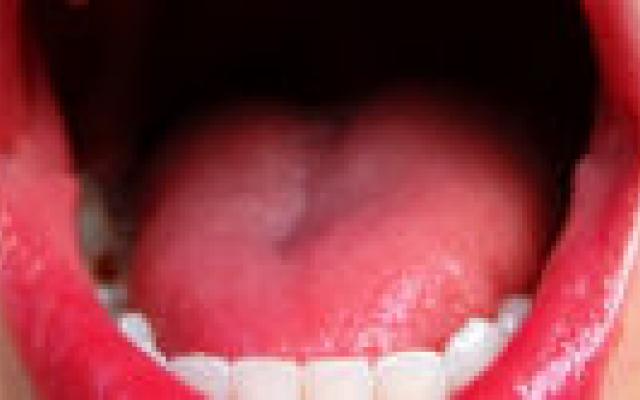 Grieptablet onder de tong mogelijk behulpzaam tijdens grieppandemie