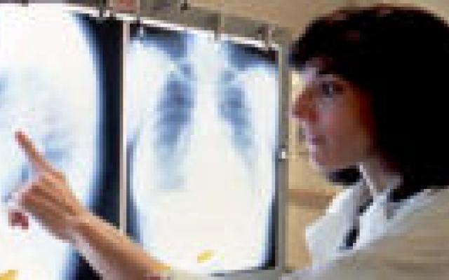 Verklaring voor overmatig gebruik radiologische diagnostiek