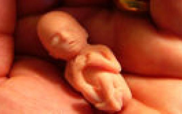 Wet verplicht duidelijkheid over abortus