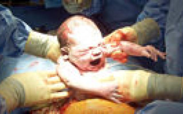 Grote obstetrische bloedingen rond bevalling