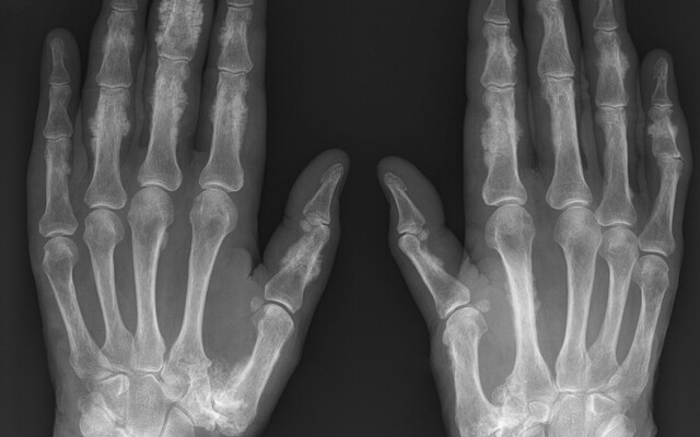 Beeld uit artikel Beeld uit artikel