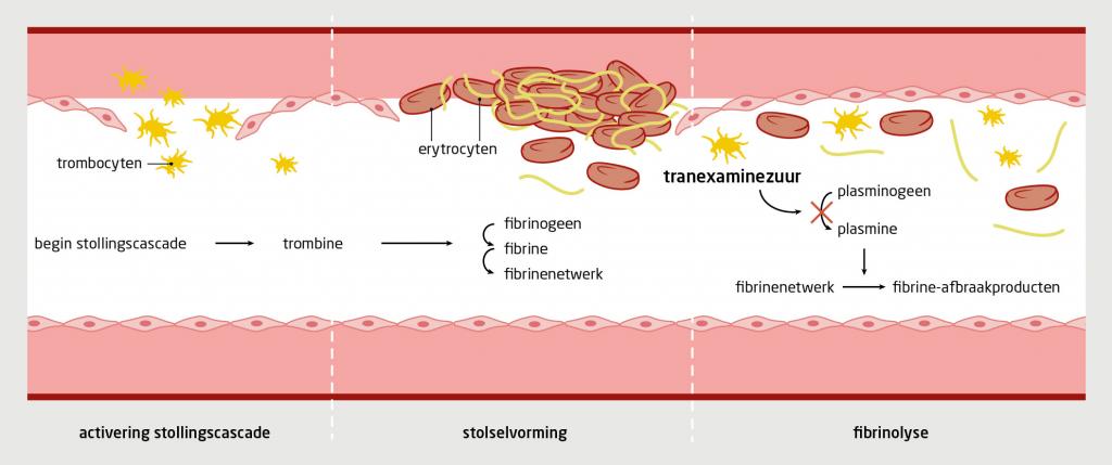 Figuur | Effect van tranexaminezuur op de hemostase