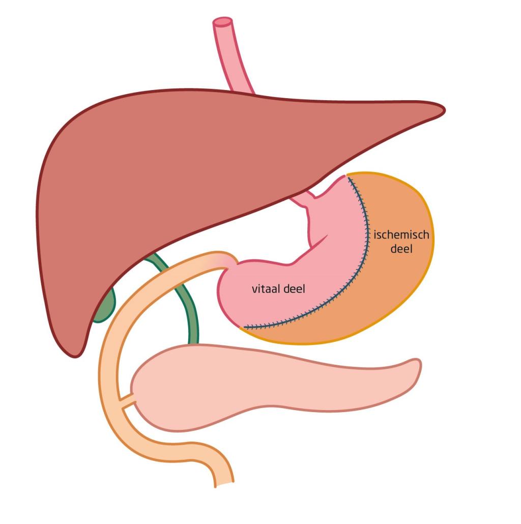Illustratie van de maag, lever en alvleesklier